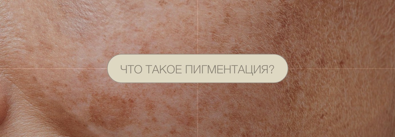 ЧТО ТАКОЕ ПИГМЕНТАЦИЯ? ЧТО ТАКОЕ ПИГМЕНТАЦИЯ?